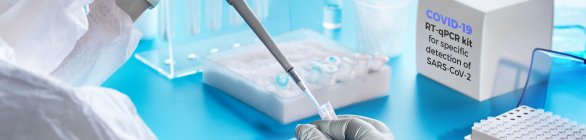 Resultado positivo para Covid aumenta nos últimos 15 dias