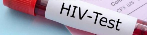 Tempo de vida de pessoas com HIV mais que dobra no Brasil